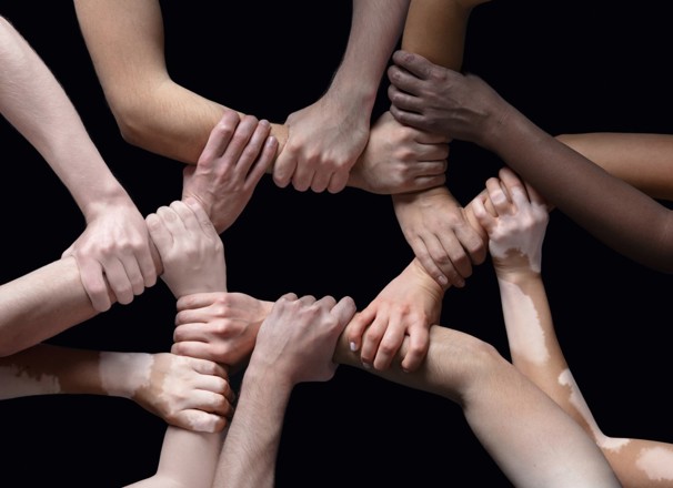 arms linked together for teamwork